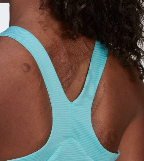 Adidas Women's Paris Tennis Y-Tank Top - Image 3